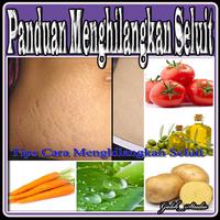 Panduan Menghilangkan Seluit পোস্টার