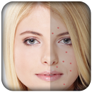 Pimple Remover-Pimple Eraser APK