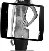 XRay Scanner Prank Plakat
