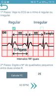 ECG Report syot layar 2