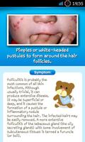 Baby Skin Problem & Guide Lite captura de pantalla 2