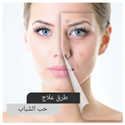علاج حب الشباب Zeichen
