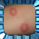 Ringworm Home Treatment APK