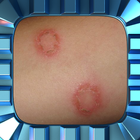 Ringworm Home Treatment 图标