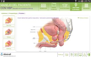 Manejo del paciente con HBP capture d'écran 3