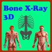 Bone with X-Ray