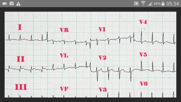 ECG New Clinical Cases 截圖 2