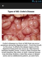Crohns Disease Symptoms capture d'écran 1