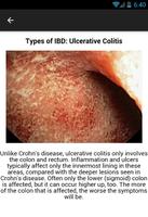Crohns Disease Symptoms capture d'écran 3
