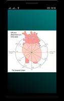 Basic ECG Information capture d'écran 2