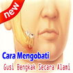 Cara Mengobati Gusi Bengkak Alami dan Manjur