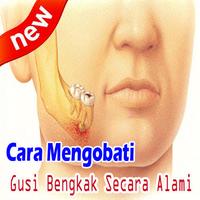 Cara Mengobati Gusi Bengkak Alami dan Manjur الملصق