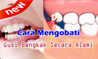 Cara Mengobati Gusi Bengkak Alami dan Manjur تصوير الشاشة 1