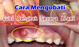 Cara Mengobati Gusi Bengkak Alami dan Manjur تصوير الشاشة 2