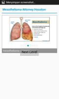 Mesothelioma Attorney Houston ảnh chụp màn hình 2