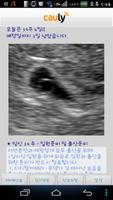 All About Pregnant - 임신정보의 모든것 capture d'écran 1