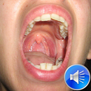 Burp Sounds RIngtones APK
