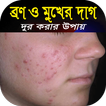 ব্রন ও মুখের দাগ দূর করার সহজ উপায়-রূপচর্চার নিয়ম
