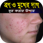 ব্রন ও মুখের দাগ দূর করার সহজ উপায়-রূপচর্চার নিয়ম أيقونة