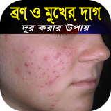 ব্রন ও মুখের দাগ দূর করার সহজ উপায়-রূপচর্চার নিয়ম أيقونة
