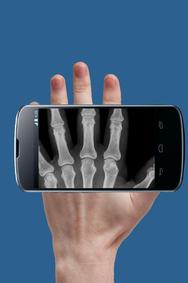 real xray app download real xray app download