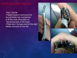 Dental Forceps and Elevators Affiche