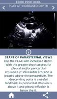 LEARN THE FULL TTE ECHO ULTRASOUND PROTOCOL imagem de tela 1