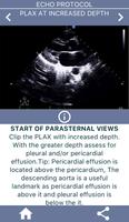 LEARN THE FULL TTE ECHO ULTRASOUND PROTOCOL capture d'écran 1