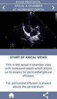 LEARN THE FULL TTE ECHO ULTRASOUND PROTOCOL imagem de tela 2