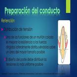 Postes intrarradiculares