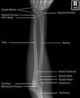 Radiological Projections screenshot 1