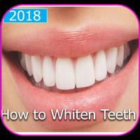 teeth whitening 2018 تصوير الشاشة 2