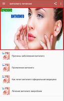 витилиго лечение Affiche