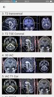 MRI POSITIONING captura de pantalla 3