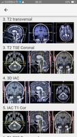 MRI POSITIONING capture d'écran 3