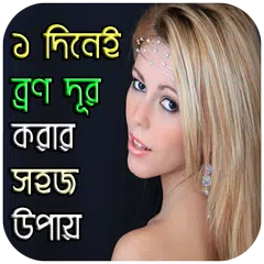 ১ দিনেই ব্রণ দূর করুন APK Herunterladen