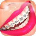 Braces Booth Plus