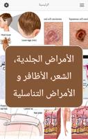 الأمراض الجلدية و التناسلية الملصق