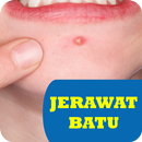 Cara Mengobati Jerawat Batu APK