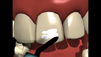 Зубы [Teeth] ảnh chụp màn hình 1