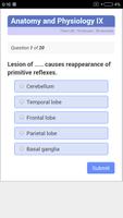 USMLE Neurology Review Affiche