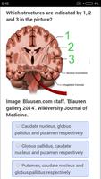 USMLE Neurology Review capture d'écran 2