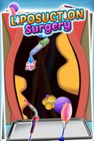 Liposuction Surgery : Fatty Body Laser Liposuction Screenshot 3
