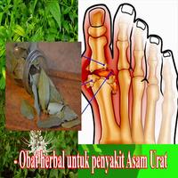 Obat Asam urat secara herbal-poster