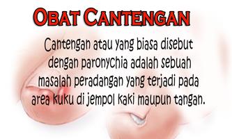 Obat Cantengan Alami screenshot 2