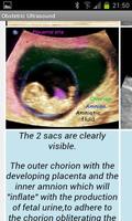 Obstetric Ultrasound-Lite capture d'écran 1
