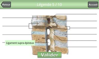 Netter Quiz imagem de tela 2