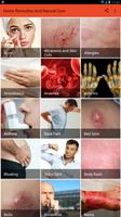 105+ Home Remedies And Natural Cure-poster