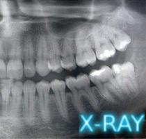 Dental X-Ray Affiche