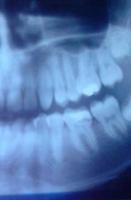 Dental X-Ray imagem de tela 2